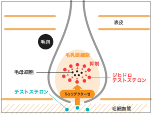 フットボールアワー岩尾髪の毛