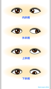 フースーヤ谷口の目は色盲